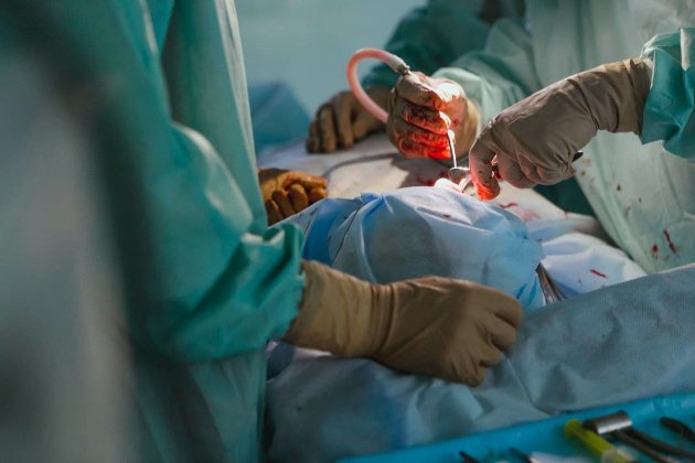Хірурги дві години оперували мешканця Львівщини, який на спір проковтнув кулькову ручку