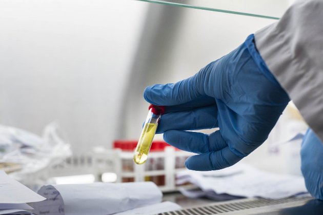 У лютому Україна отримає перший мільйон доз вакцин від COVID-19 виробництва Serum Institute, обіцяє Степанов