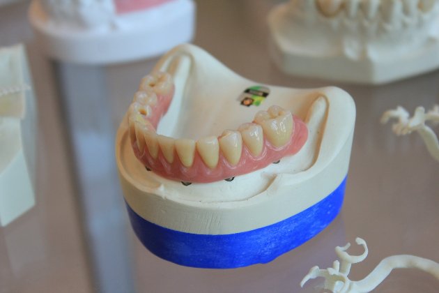 Ветерани зможуть безкоштовно протезувати зуби — Шмигаль