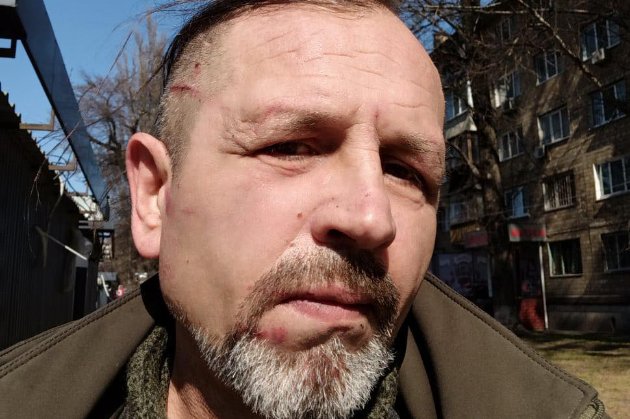 Поліція перевіряє інформацію про побиття колишнього політв'язня Кремля у київському ТЦК