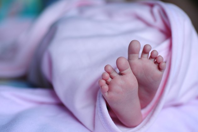 Один случай на 500 тыс. В Израиле родилась девочка с близнецом в животе