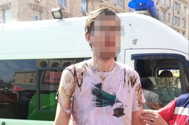 Під час святкування Дня Незалежності у Києві чоловік підпалив сам себе