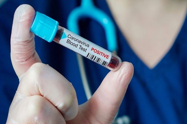 Китай розпочав вакцинацію від COVID-19, хоча її безпека не доведена