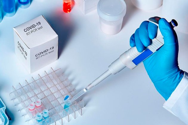 Україна почала закуповувати тести на антиген коронавірусу. Вони виявляють COVID-19 за пів години