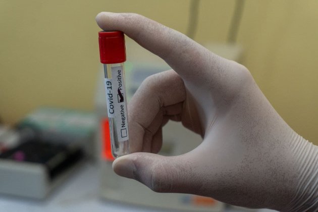 Новий штам коронавірусу, який виявили у Південній Африці, отримав назву