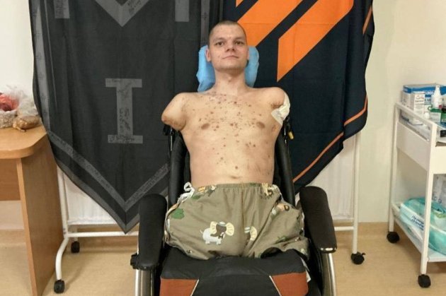 У Приватбанку відмовились видати картку 20-річному ветерану війни без рук і ніг