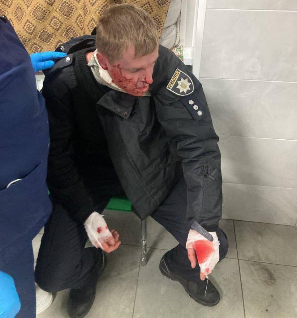 поранений ракетою поліцейський у Запоріжжі