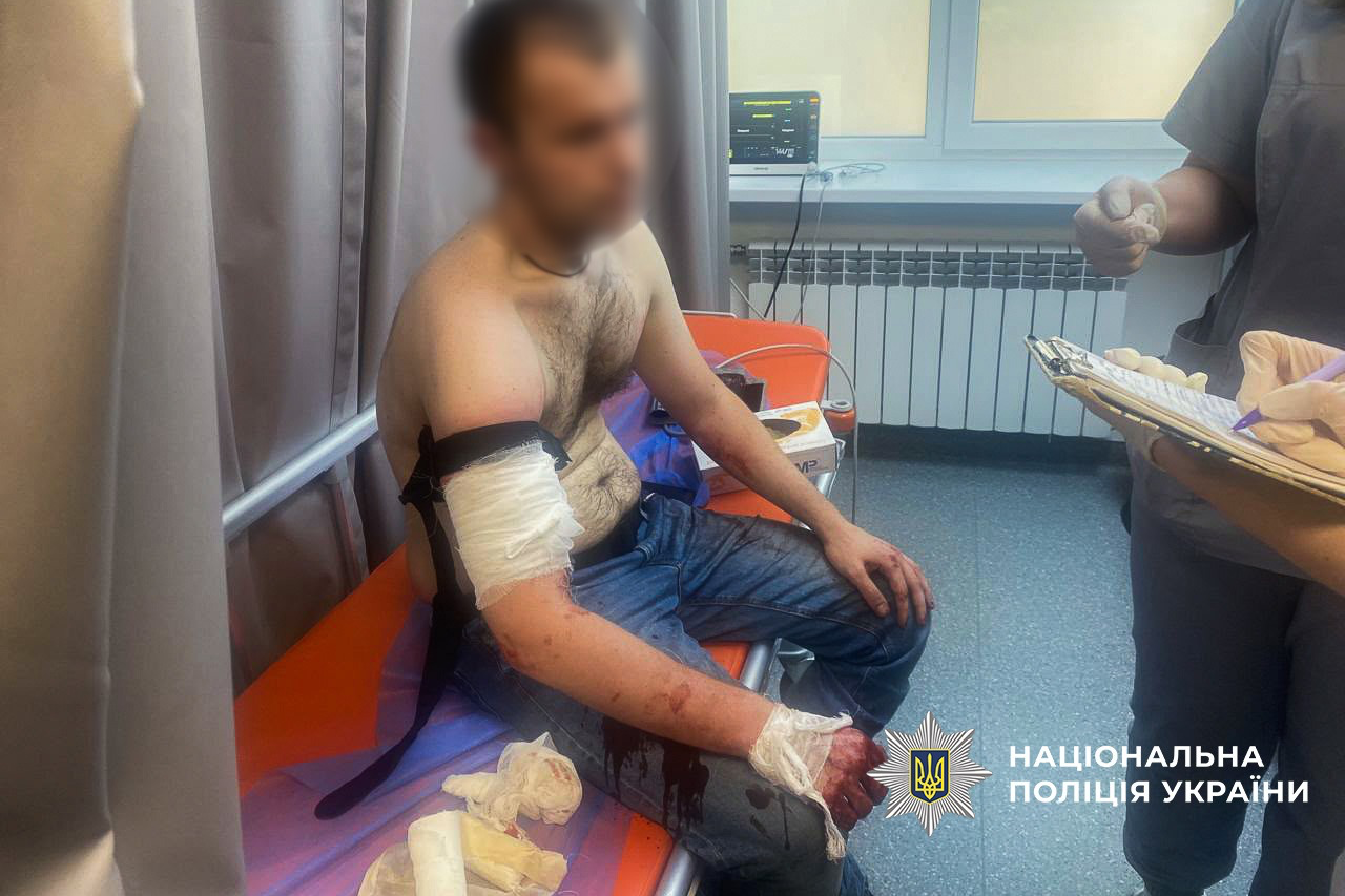 У Запоріжжі чоловік із ножем напав на поліцейських під час обшуку: нападника застрелили