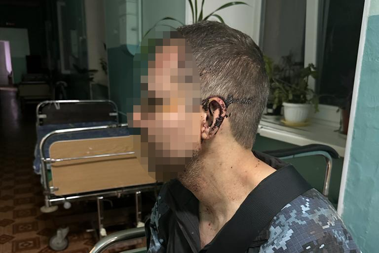 На Одещині капітан побив підлеглого військового: ДБР розпочало розслідування